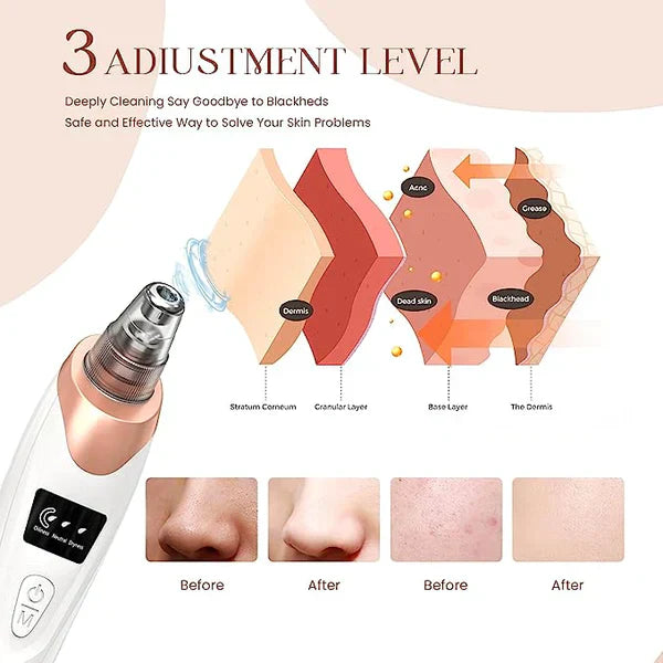 Electric Blackhead Remover Pore Vacuum Sucction machine